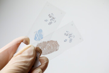 Close up photo of hand in white glove handing Immunohistochemical  brain tissue sample