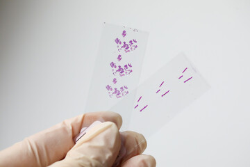 Close up photo of hand in white glove handing histological brain tissue sample