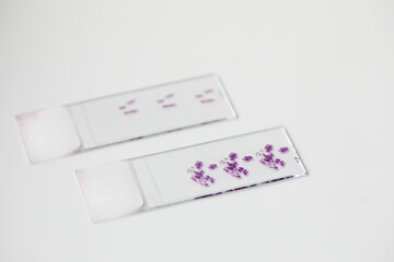 Fototapeta na wymiar Close up photo of glass with histological brain tissue sample