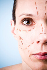 Obraz premium Woman's face with correction lines drawn for lifting procedure in surgery. Studio photo in blue background.