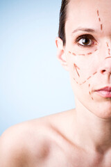 Woman's face with correction lines drawn for lifting procedure in surgery. Studio photo in blue background.