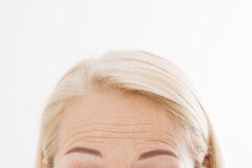 Macro Woman face with wrinkles on the forehead. Collagen and face injections concept. Menopause. Cropped image. Copy space and mock up.