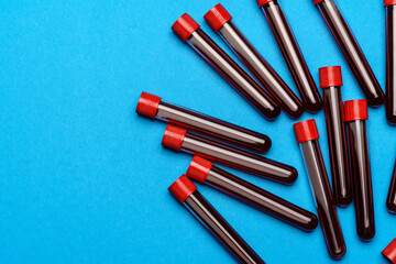 top view of medicine test tubes with blood samples over blue background