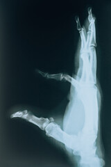 Hand x-ray. Hand bone injury