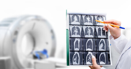Radiologist showing tomography scan of a patient's lungs over of CT machine. Treatment of lung...