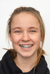 Portrait - Mädchen mit Zahnspange 