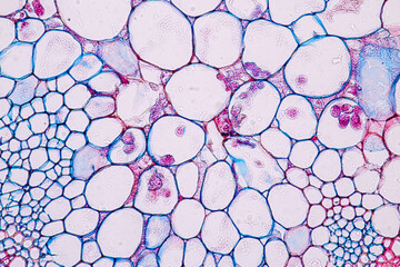 Zygomycota, or zygote fungi ,Downy mildew of cruzifers host tissue with conidia living in decaying...