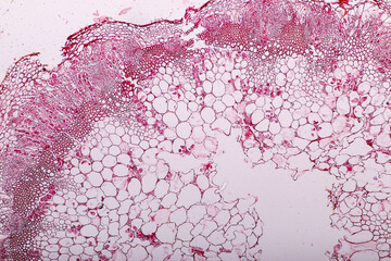 Zygomycota, or zygote fungi ,Downy mildew of cruzifers host tissue with conidia living in decaying...
