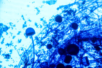  Characteristics of Rhizopus is a genus of common saprophytic fungi  on Slide under the microscope...