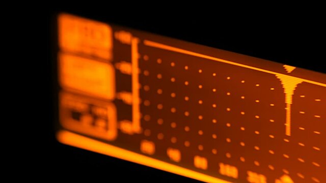 Feedback suppressor allows the use of a strong reduction the signal level of the specified frequency ranges, to remove certain frequencies leading to feedback. Closeup
