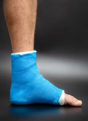 Close up photos of foot blue splint for treatment of injuries from ankle sprain.