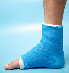 Close up photos of foot blue splint for treatment of injuries from ankle sprain.