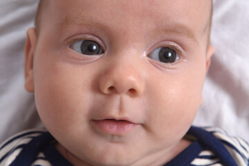 front view of a baby who looks to the side with his eyes