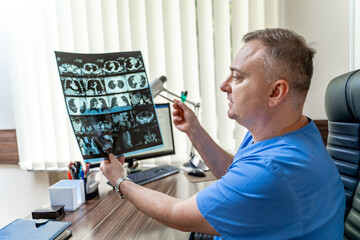 Doctor examining x-ray of a patient. Male radiologist sitting at table. Medical office background.
