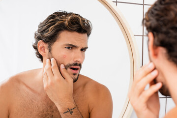 Worried man touching cheek with acne while looking at mirror in bathroom