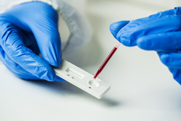 Scientist or doctor placing blood sample on Rapid Diagnostic Rest RDT cassette,medical technician...
