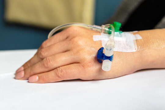 Hand einer jungen Frau mit angelegtem peripheren Venenkatheter