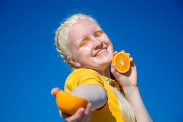 A young albino woman holds out a slice of orange to the camera, against a blue sky.