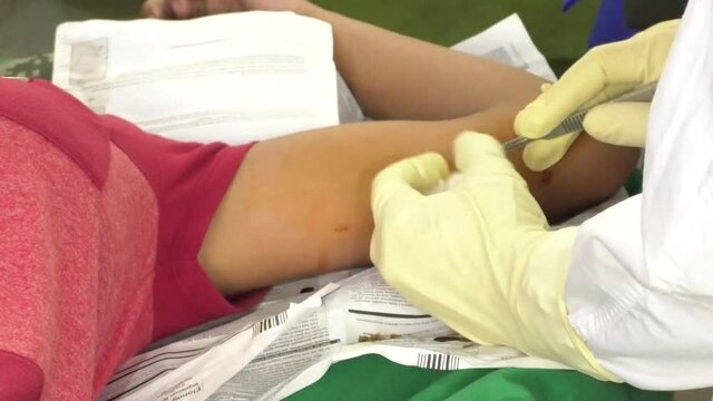 A doctor  injects Progestin Sub-dermal implant (PSI) to a mother as a birth control method