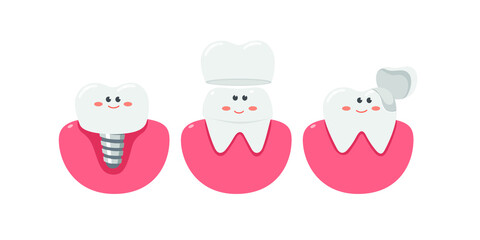 Healthy teeth with a dental implant, healthcare, flat design vector illustration.