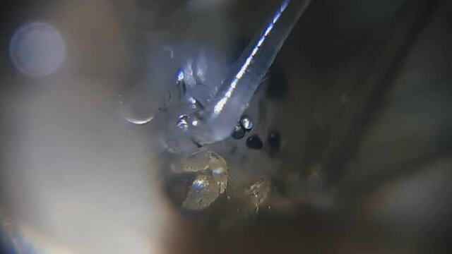 Tiny Transparent Spider Eyes From Very Close