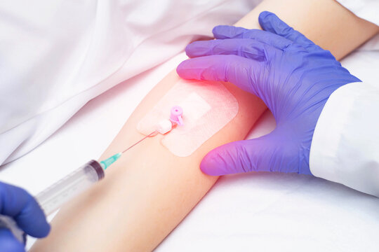 A doctor puts a venous catheter to a patient to inject drugs into a vein, close-up. Treatment