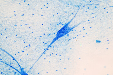 Education Spinal cord  and Motor Neuron under the microscope in Lab.
