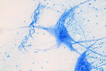 Education Spinal cord  and Motor Neuron under the microscope in Lab.
