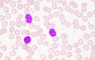 Mature lymphocyte on red blood cells background.