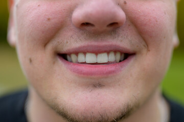 Close up on the teeth of a smiling young man