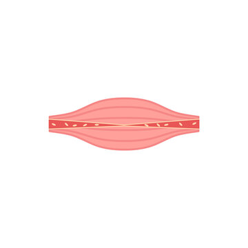 Unhealthy muscle color icon. Medical anatomy symbol. Blood flow worse concept. Painful muscle fiber structure vector illustration isolated on white. 