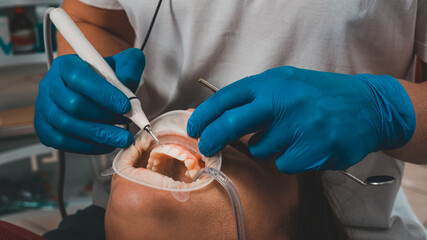 At the dentist's appointment, tartar removal, use of ultrasound, patient and dentist. Retractor for...