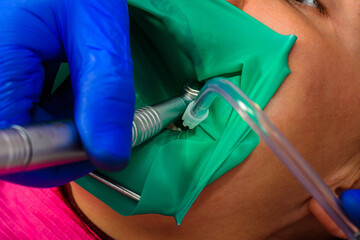 dentist treats the tooth with modern methods, uses a rubber dam, sterile tooth treatment.