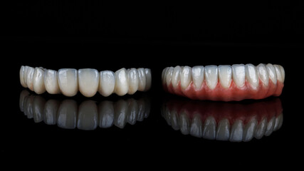 two dentures for the upper and lower jaw made of ceramics and polymeric materials, photo on a black background with reflection