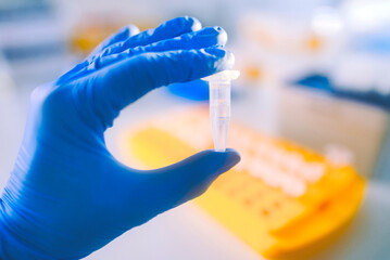 Laboratory blood tests for viral infections or cancer. Coronavirus nCoV, MERS-Cov respiratory...