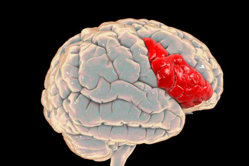 Human brain with highlighted inferior frontal gyrus