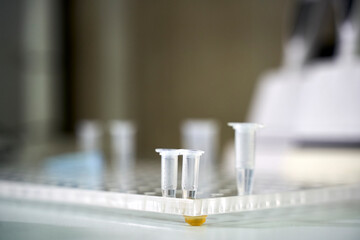 collection of patient tests in the laboratory