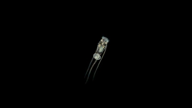 Rotifera Filinia terminalis under the microscope, Trochosphaeridae family. Distributed in the pelagic zone and in the littoral plankton. Lake Baikal