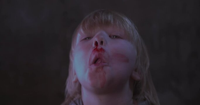 blond boy covered in blood. child has weak vessels in nose, bursting with pressure drops and changes in weather. Hemophilia disease.  kid raises her head to stop bleeding