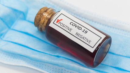 Medical flask with human analysis for coronavirus (COVID-19)