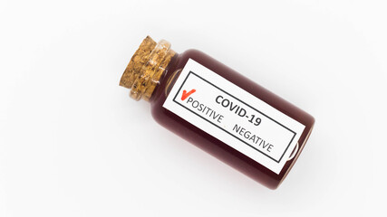 Medical flask with human analysis for coronavirus (COVID-19)