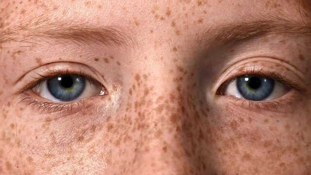Blue eye of a red-haired girl with lots of freckles on the face, looking into the camera. Close up