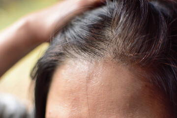 白髪が気になる女性