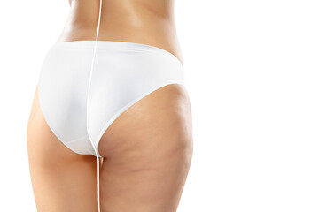 Overweight woman with cellulite legs and buttocks in white underwear comparing with fit and thin body isolated on white background. Orange peel skin, liposuction, healthcare, beauty, sport, surgery. - obrazy, fototapety, plakaty