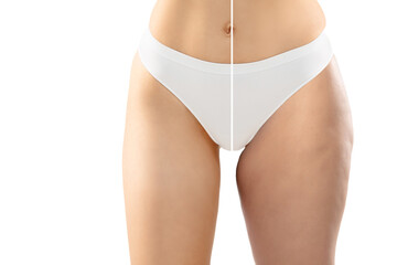 Overweight woman with cellulite legs and belly in white underwear comparing with fit and thin body isolated on white background. Orange peel skin, liposuction, healthcare, beauty, sport, surgery. - obrazy, fototapety, plakaty