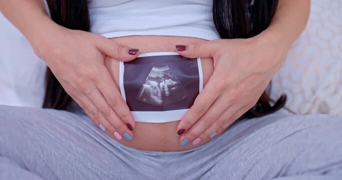 Close-up, a pregnant woman holding an ultrasound picture of a child in her hands, motherly love. Happy motherhood, embryo photography. 4k, ProRes