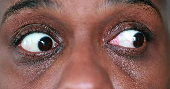 Fearful African man feeling paranoid and afraid, macro close-up eyes