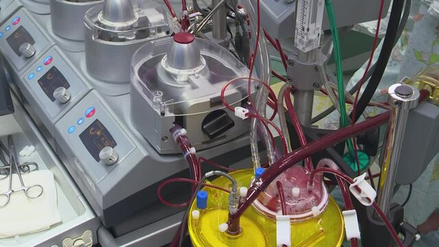 Operation on a stopped heart with a cardiopulmonary bypass machine.