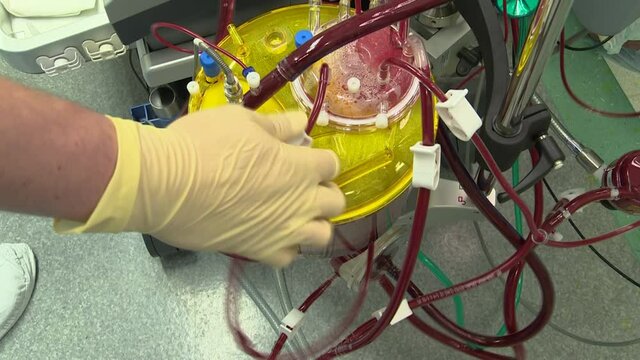 Operation on a stopped heart with a cardiopulmonary bypass machine.