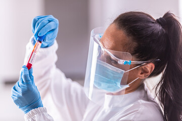 Healthcare employee wearing proper personal protective equipment looks at a positive sample of the...
